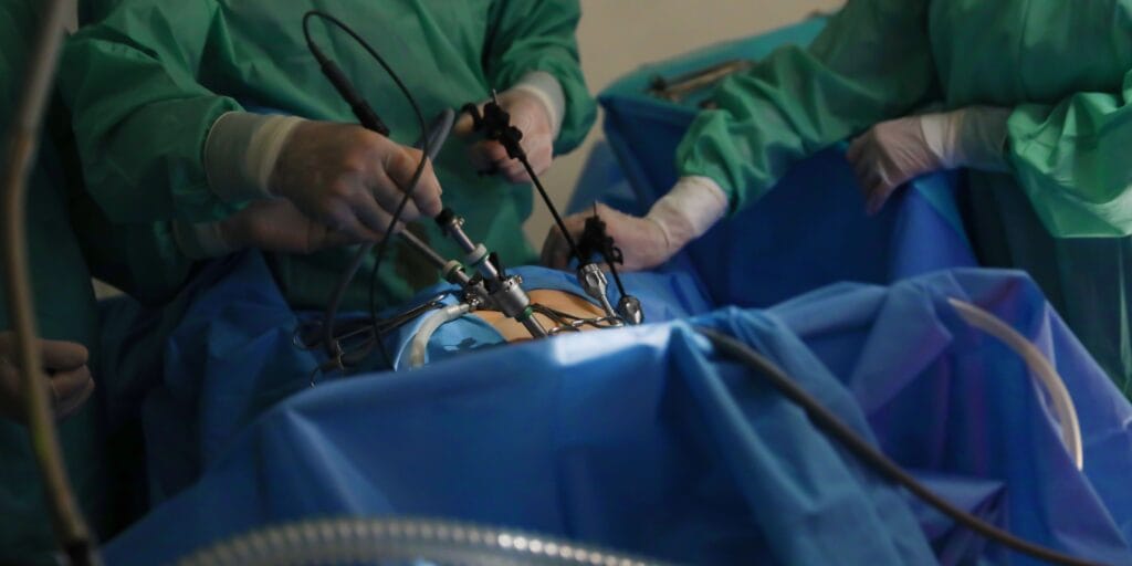 Laproscopy Surgery